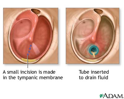 Procedure