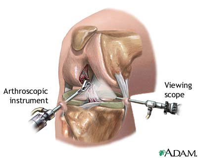 Procedure, part 1