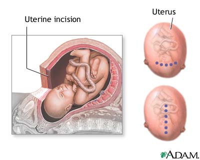 Procedure, part 3