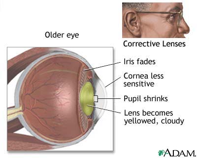 Aged eye anatomy