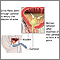 Bladder catheterization, male