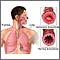 Asthmatic bronchiole and normal bronchiole