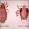 Head louse and pubic louse