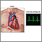 Electrocardiogram (ECG)