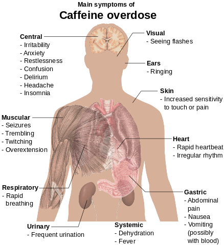 File:Main symptoms of Caffeine overdose.svg